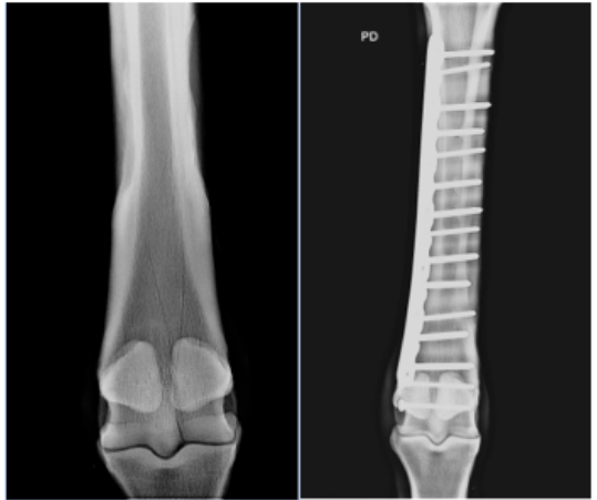 Fracture du canon